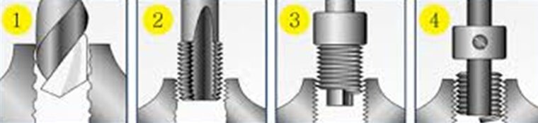 m14x1.5 draadreparatie set - helicoil set - schroefdraad reparatieset - helicoils - schroefdraadherstel set